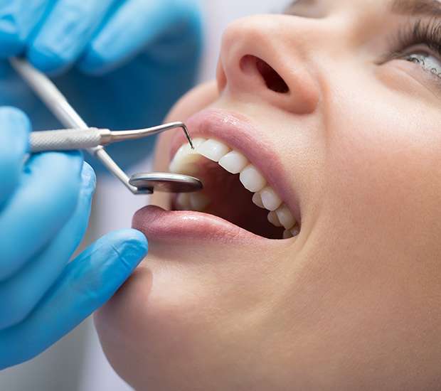 Onalaska Dental Bonding