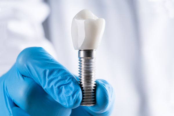 Factors To Consider With A Dental Implant