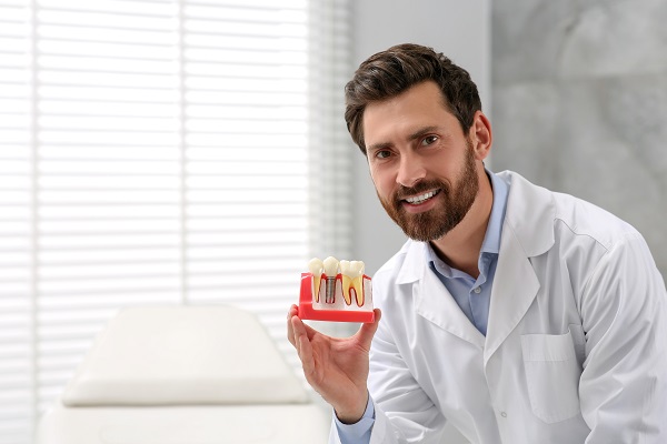 How Important Is The Bone Grafting Process For Dental Implants?