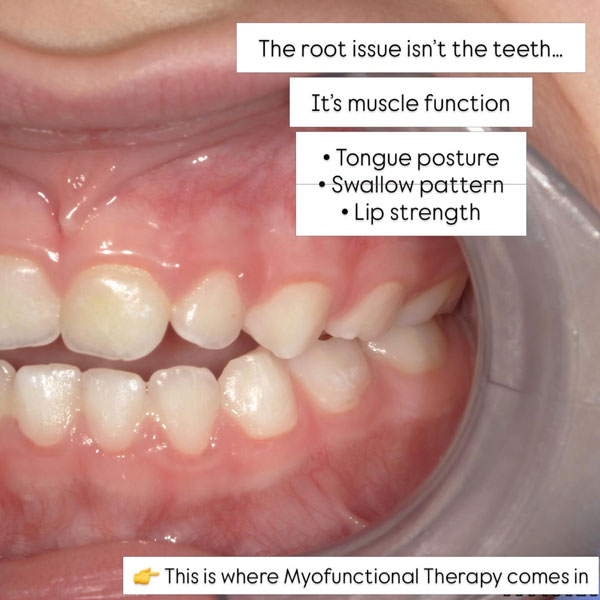 example case airway