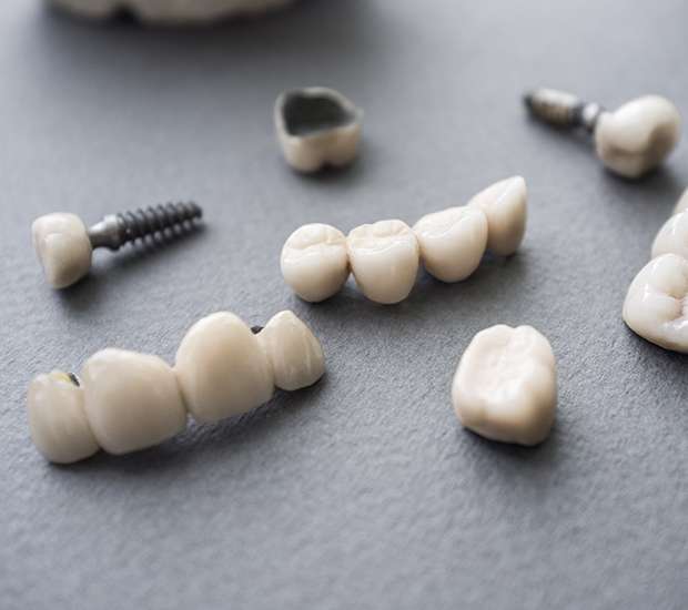 Onalaska The Difference Between Dental Implants and Mini Dental Implants