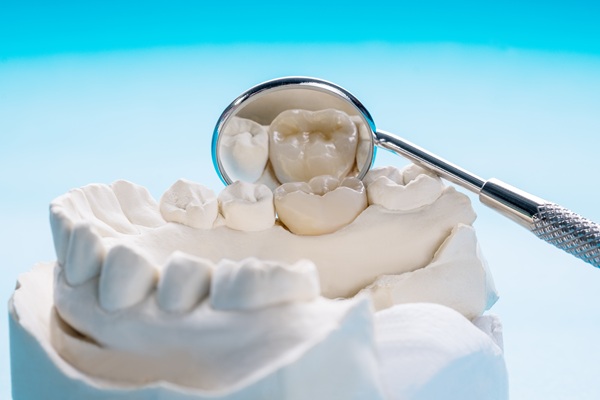 Same Day Crowns: How You Can Restore Your Smile In A Single Visit