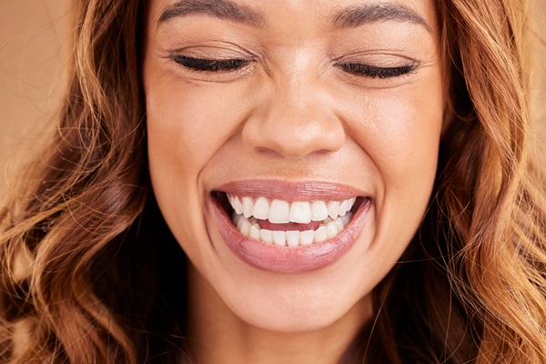 Reasons To Get A Smile Makeover